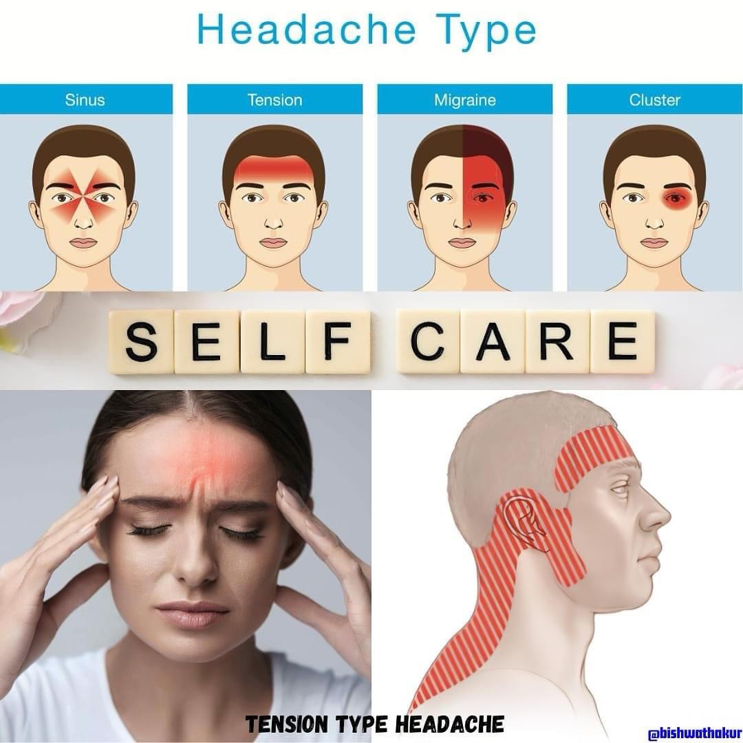 Tension Type Headache (TTH)/तनाव-प्रकारको टाउको दुखाइ Dr Bishwa Thakur