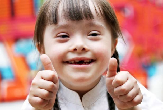 Dental Issues & Down Syndrome